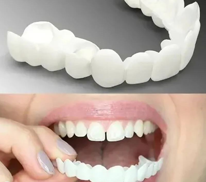Removable cosmetic dental tray