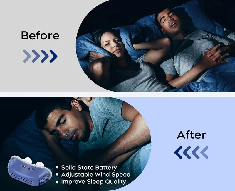 Silent anti-snoring device for better sleep